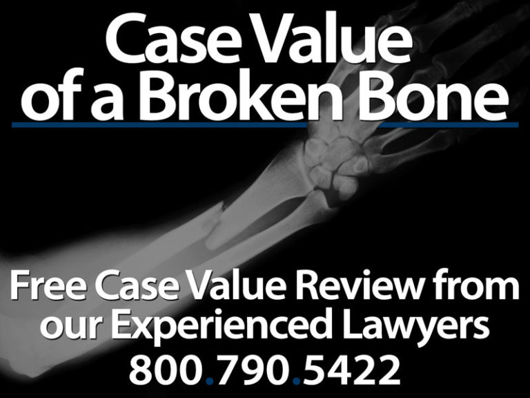 Value of a Broken Bone Lawsuit