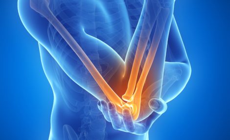What Causes Elbow Pain After Car Accident Injury Attorney