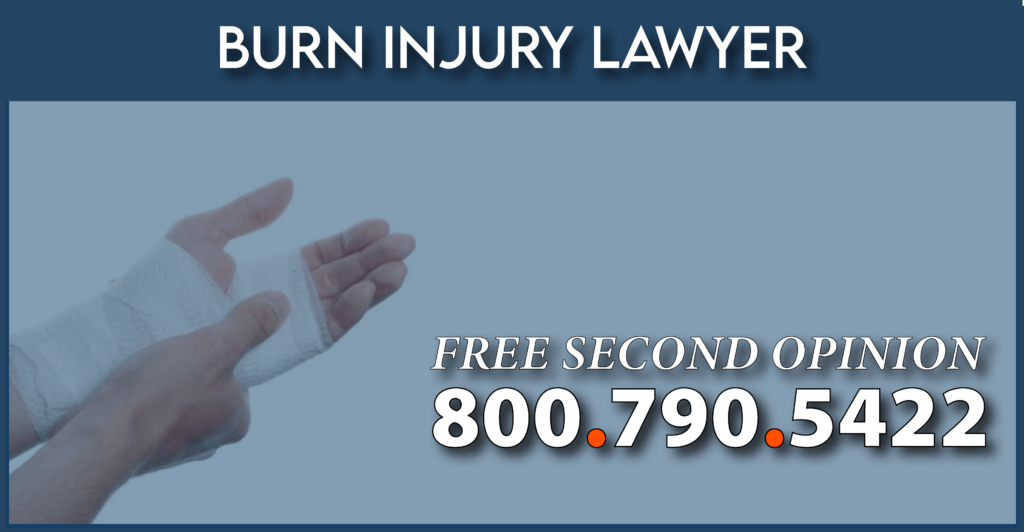 CRPS-Burn-injury-lawyer-maximum-compensation-sue-crps-attorney