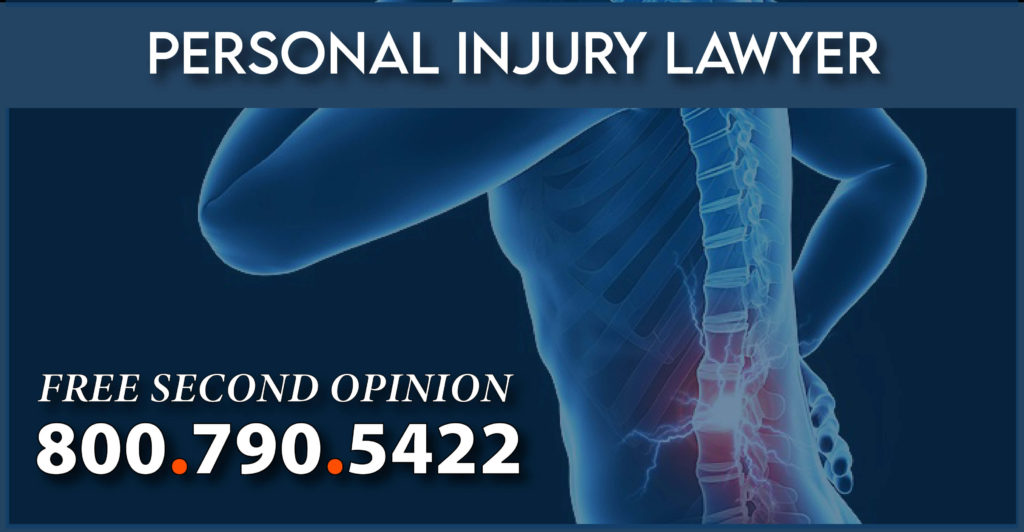 spinal cord stimulator damage personal injury lawyer attorney sue compensation