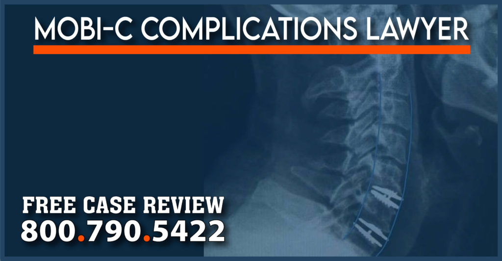 mobi-c defects complications lawyer sue surgery replacement