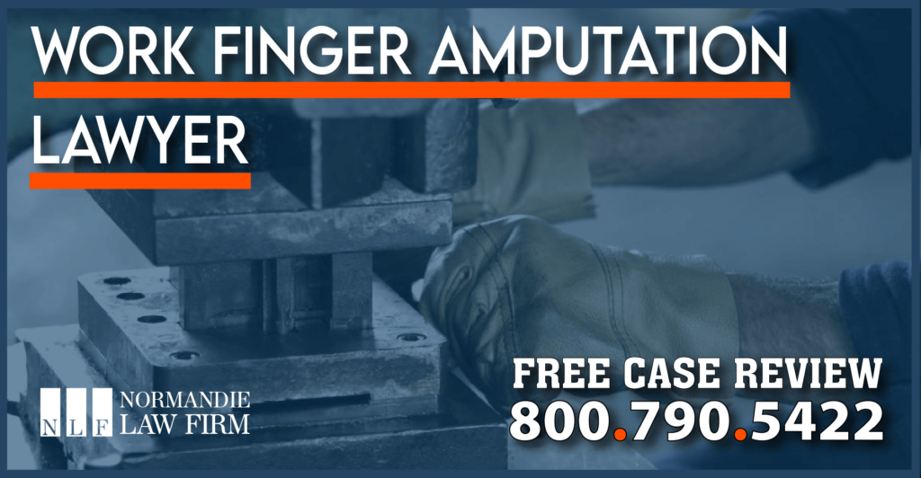 Work Finger Amputation Lawyer accident incident lawsuit sue compensation