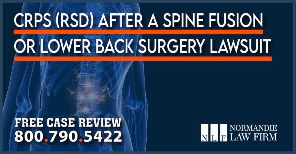 CRPS (RSD) After a Back, Spine, Fusion, Neck or Lower Back Surgery Lawsuit injury accident attorney lawyer incident malpractice