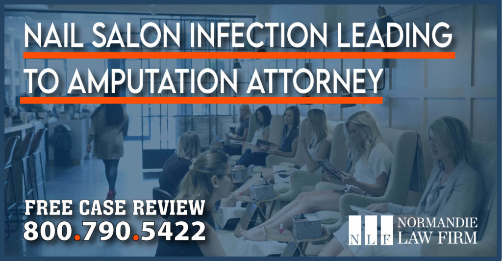 Nail Salon Infection Leading to Amputation Attorney lawyer lawsuit injury incident accident