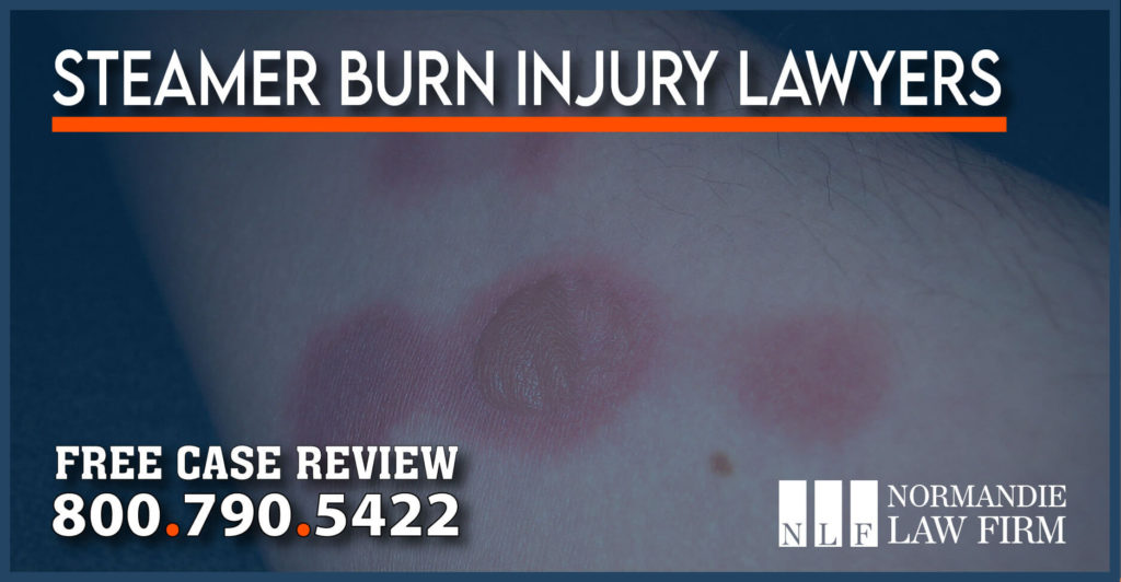 Recalled Steamer Burn Injury Lawyers to Help You Sue lawyer attorney incident accident