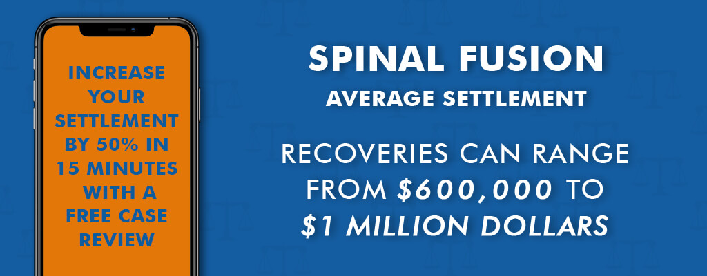 Spinal Fusion