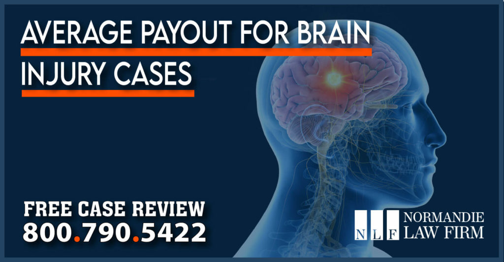 Average Payout for Brain Injury Cases lawyer attorney sue injury insurance accident recovery legal assistance