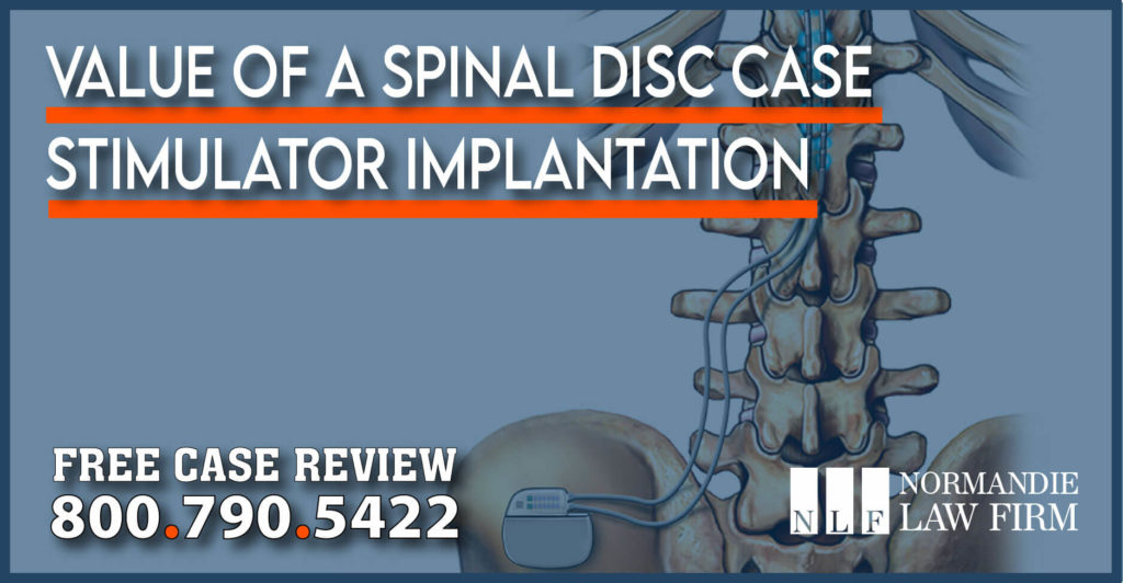 Value of a Case Involving the Implantation of a Spinal Disc Stimulator for Pain lawyer attorney sue compensation lawsuit
