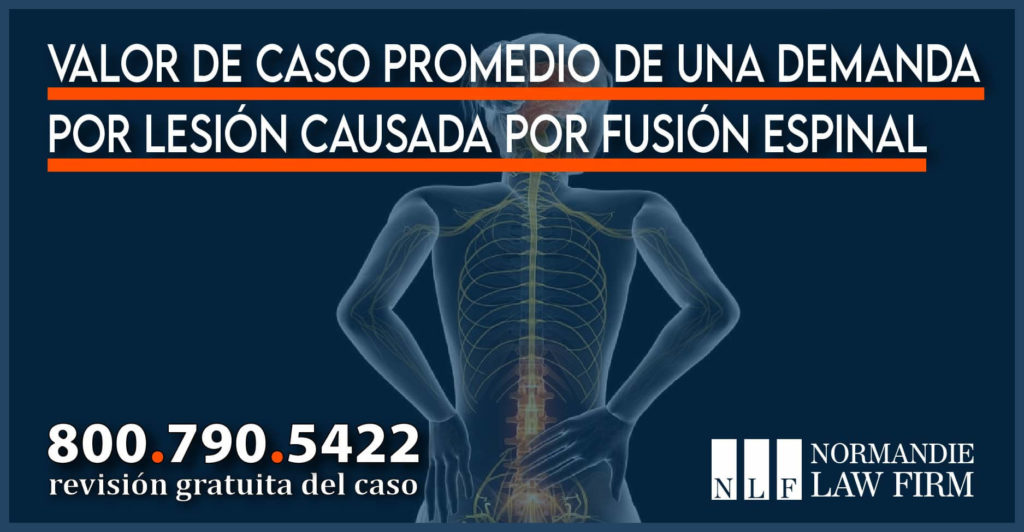 Valor de caso promedio de una demanda por lesión causada por fusión espinal abogado