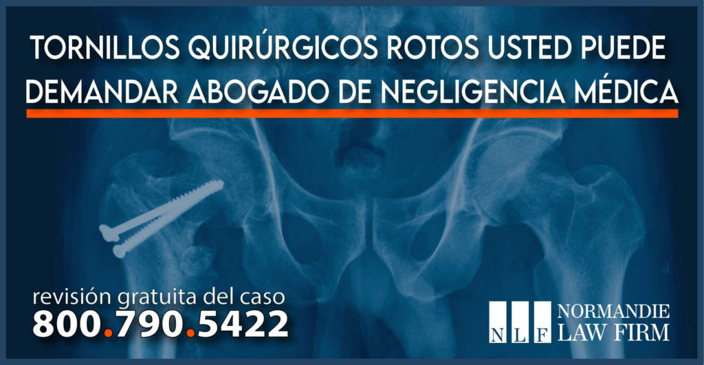 Tornillos quirúrgicos rotos - Usted puede demandar - Abogado de negligencia médica