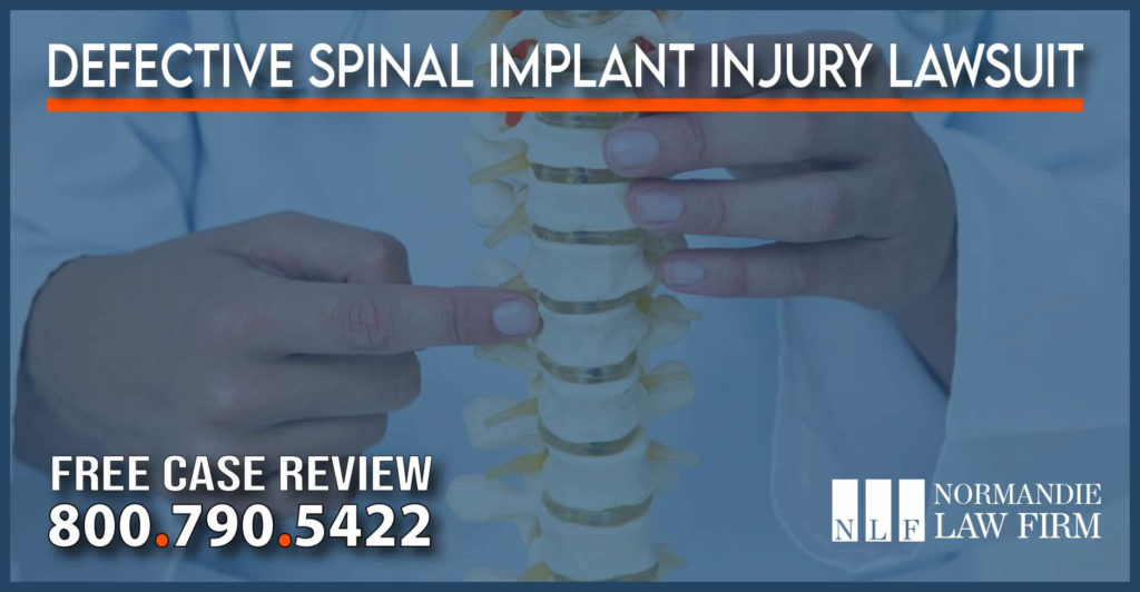 Defective Spinal Implant Injury Lawsuit lawyer attorney sue compensation