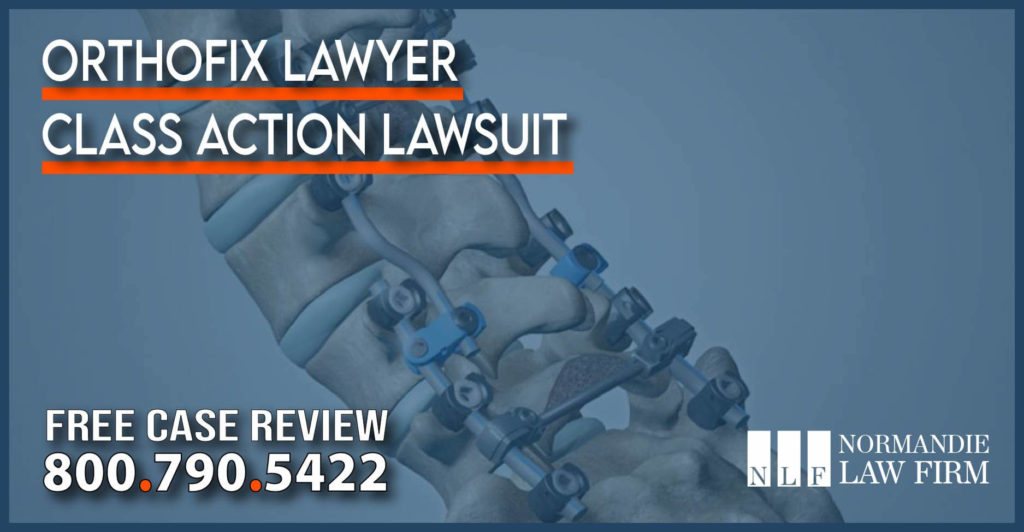 Orthofix Lawyer – Class Action Lawsuit defect personal injury accident incident attorney compensation sue