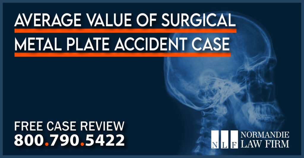 Average Value of Surgical Metal Plate Accident Case lawyer attorney sue compensation lawsuit