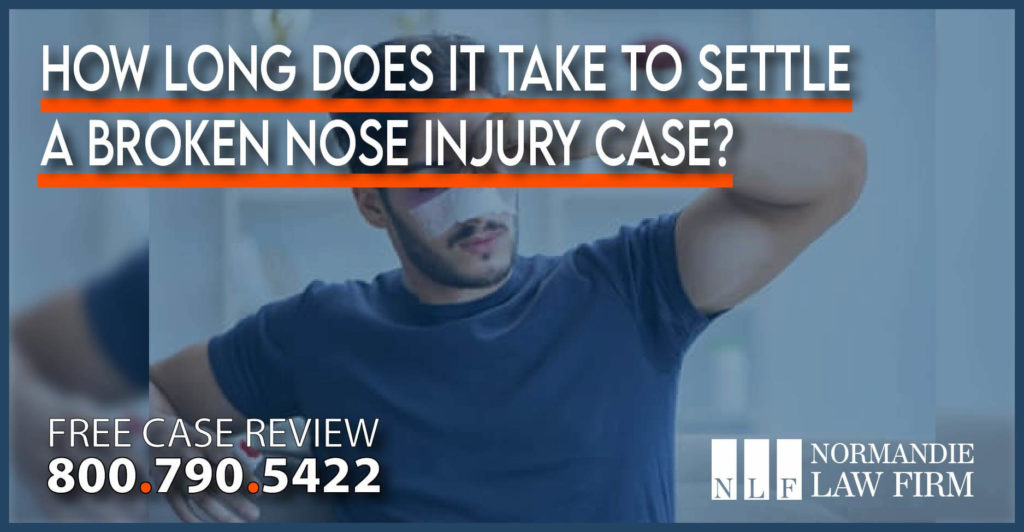 How Long Does It Take to Settle a Broken Nose Injury Case lawyer attorney compensation sue slip and fall accident incident personal injury