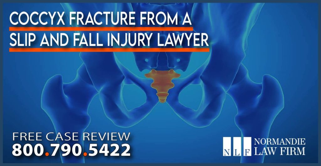 Coccyx Fracture from a Slip and Fall Injury Lawyer incident accident lawsuit sue compensation