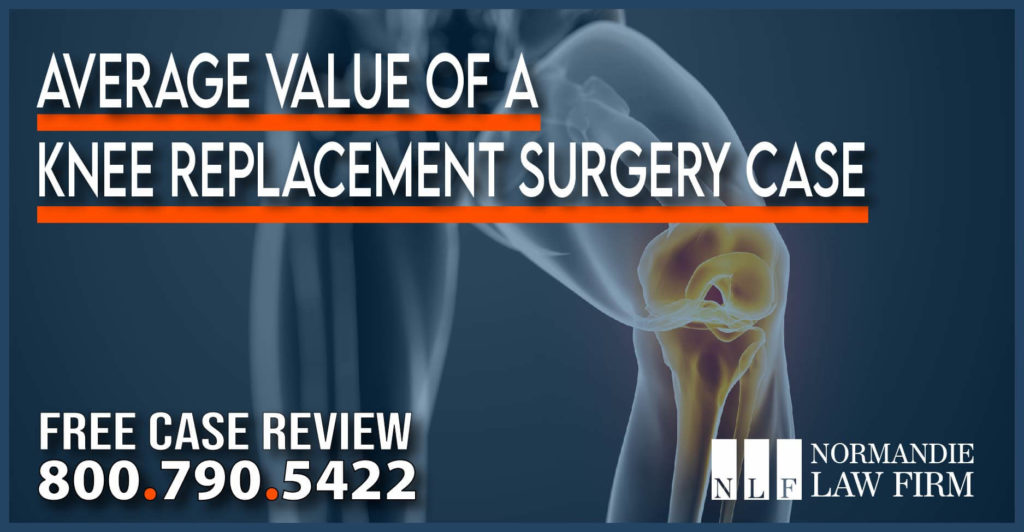 Average Value of a Knee Replacement Surgery Case personal injury lawsuit liability incident accident lawyer attorney
