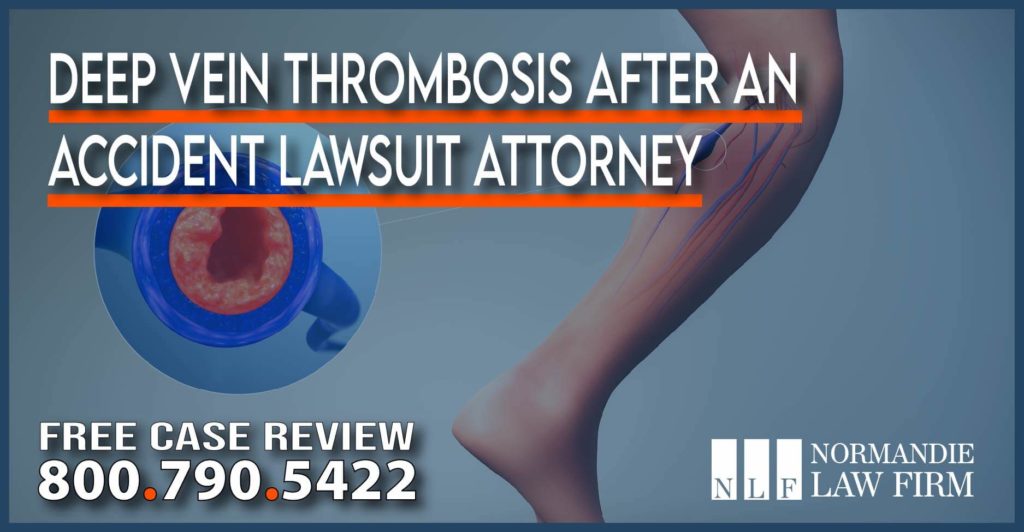 Deep Vein Thrombosis after an Accident Lawsuit Attorney lawyer incident accident liability personal injury