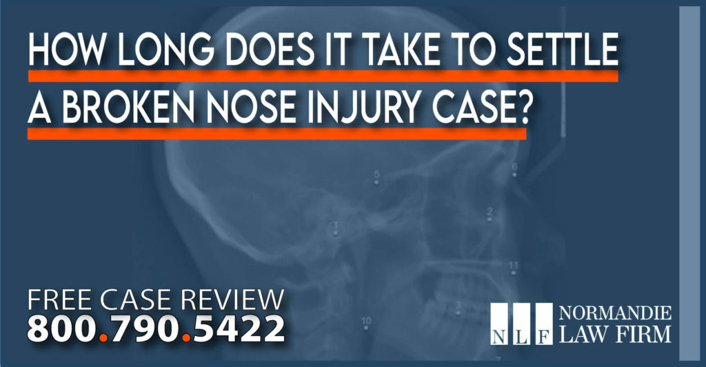 How long does it take to Settle a Broken Nose Injury Case lawyer attorney sue compensation lawsuit incident accident