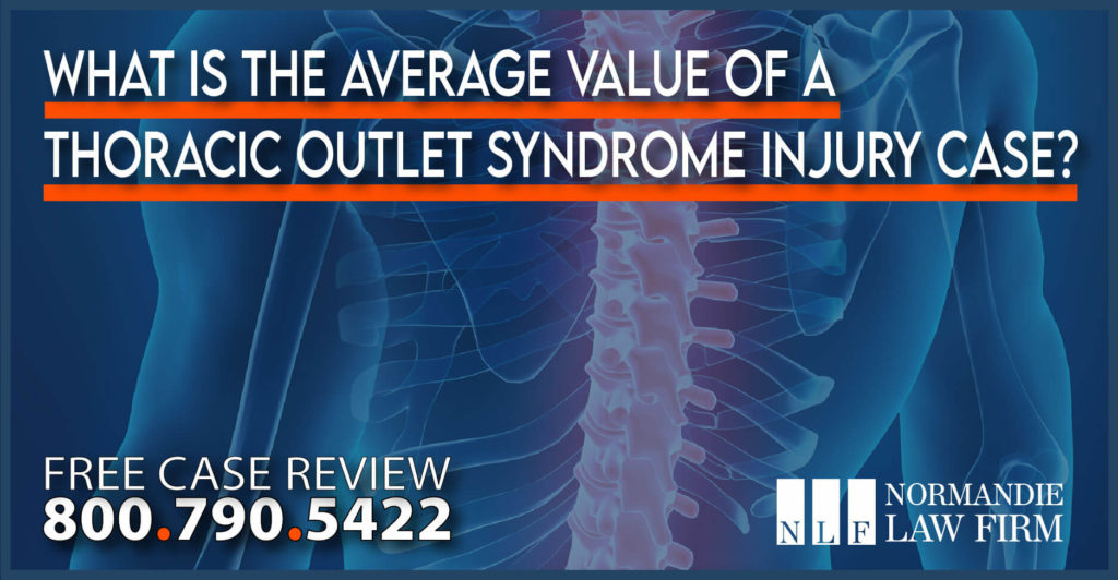 What is the Average Value of a Thoracic Outlet Syndrome Injury Case – Thoracic Outlet Syndrome Injury Lawyers attorney lawsuit sue compensation