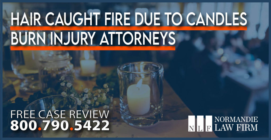 Hair Caught Fire due to Candles – Burn Injury Attorneys lawyer sue compensation liability