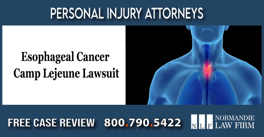 Lawyer for Esophageal Cancer Camp Lejeune Lawsuit lawyer attorney sue compensation law firm incident