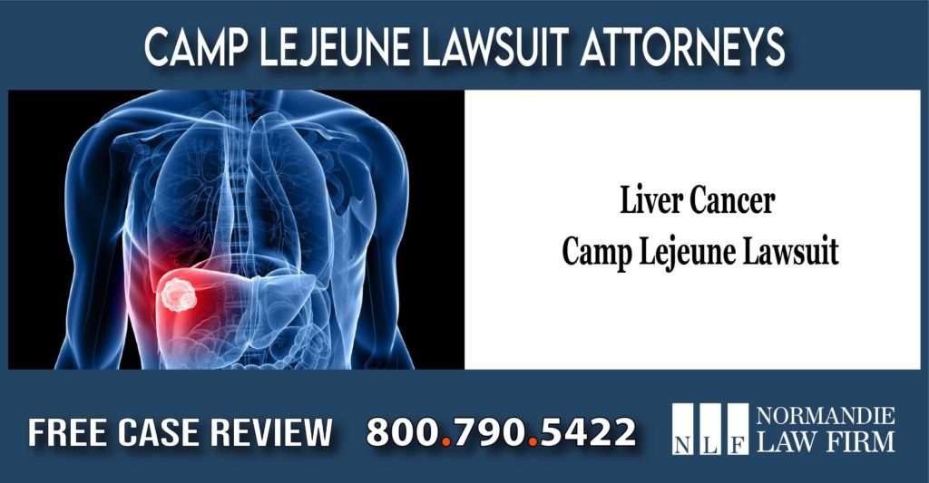 Lawyer for Liver Cancer Camp Lejeune Lawsuit lawyer attorney sue compensation