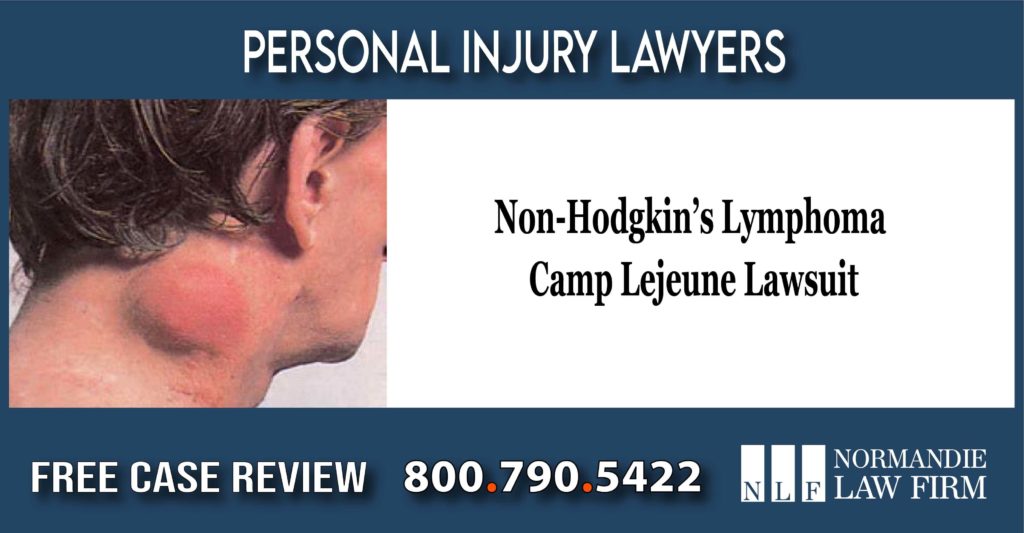 Lawyer for Non-Hodgkin’s Lymphoma Camp Lejeune Lawsuit attorney lawyer sue compensation personal injury incident liability liable