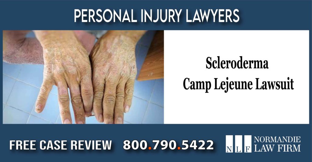 Lawyer for Scleroderma Camp Lejeune Lawsuit lawyer attorney sue compensation liability liable incident