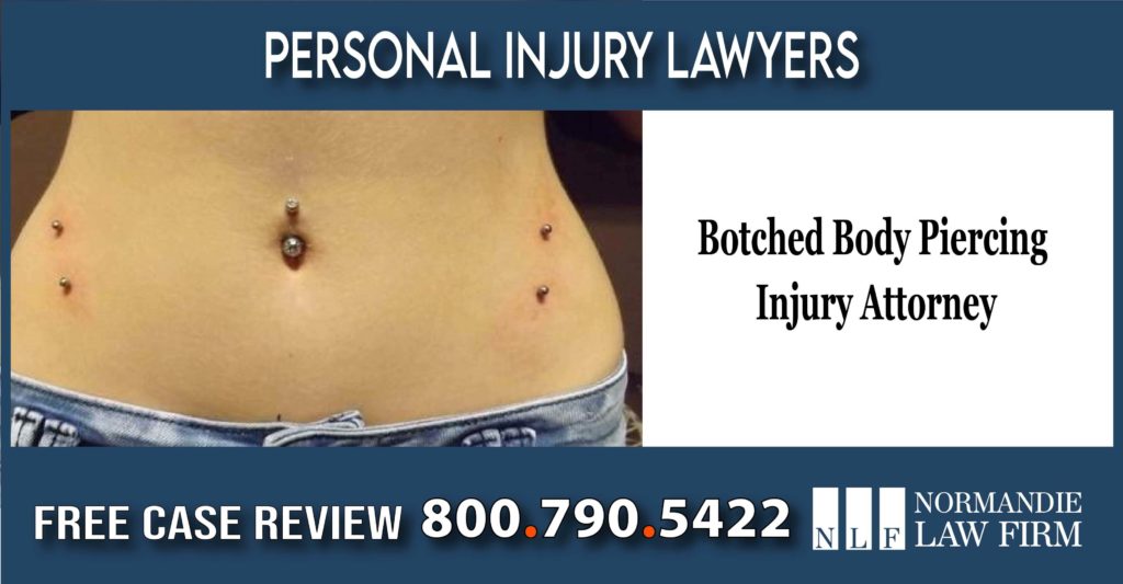Botched Body Piercing Injury Attorney layer sue lawsuit compensation infected