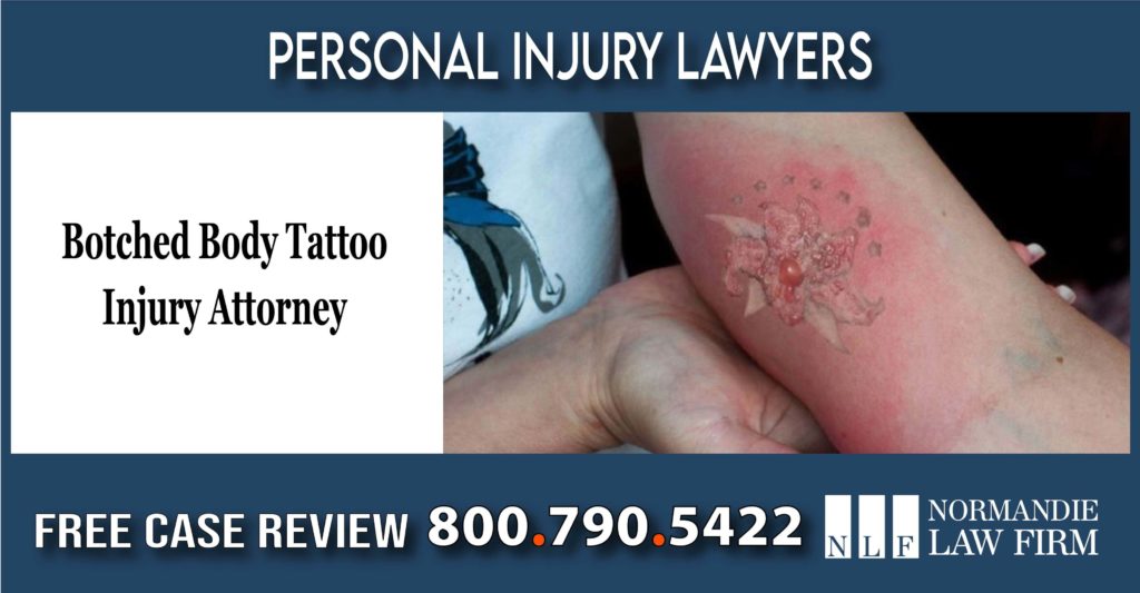 Botched Body Tattoo Injury Attorney lawyer infection personal injury sue compensation lawsuit