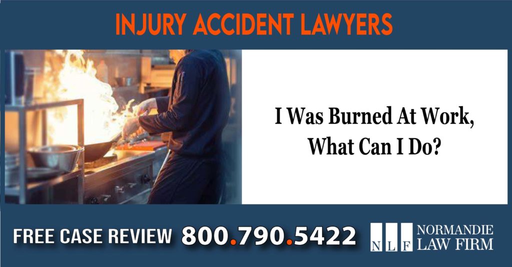 I Was Burned At Work, What Can I Do lawyer sue attorney lawsuit