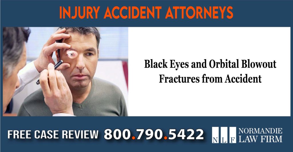 Black Eyes and Orbital Blowout Fractures from Accident Lawyer attorney sue lawsuit compensation incident