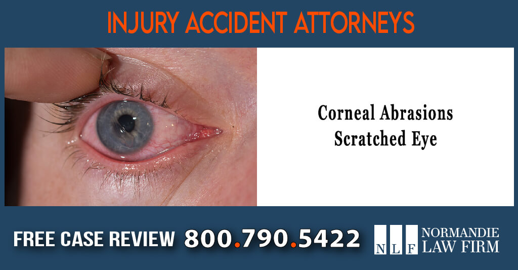 corneal abrasions scratched eye lawsuit attorney