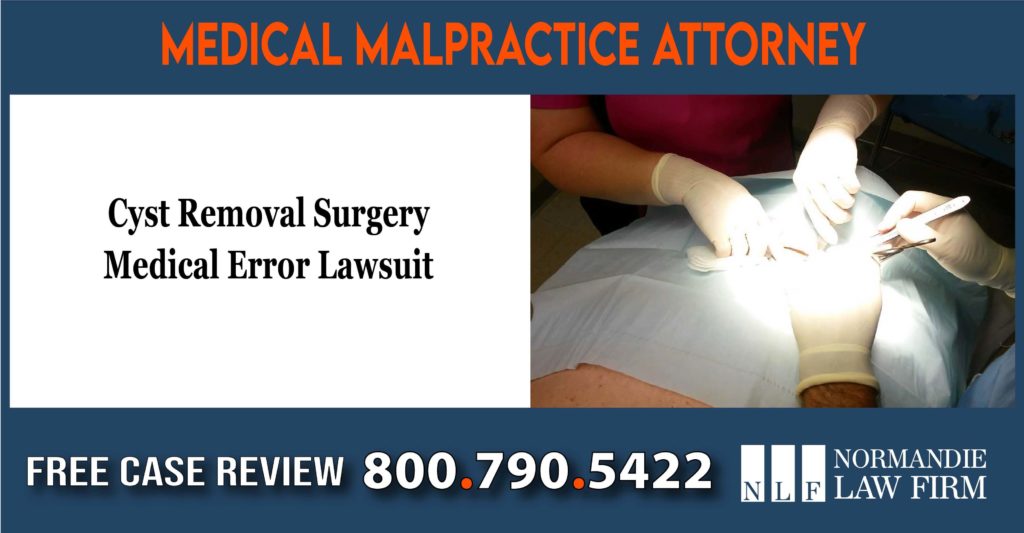 Cyst Removal Surgery Medical Error liability compensation attorney sue liable lawyer lawsuit attorney