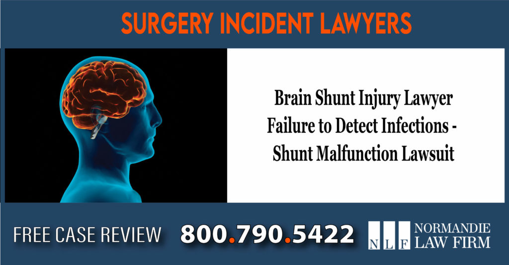 Brain Shunt Injury Lawyer - Infections - Failure to Detect Infections - Shunt Malfunction - Shunt Surgery Complications lawyer attorney lawsuit sue