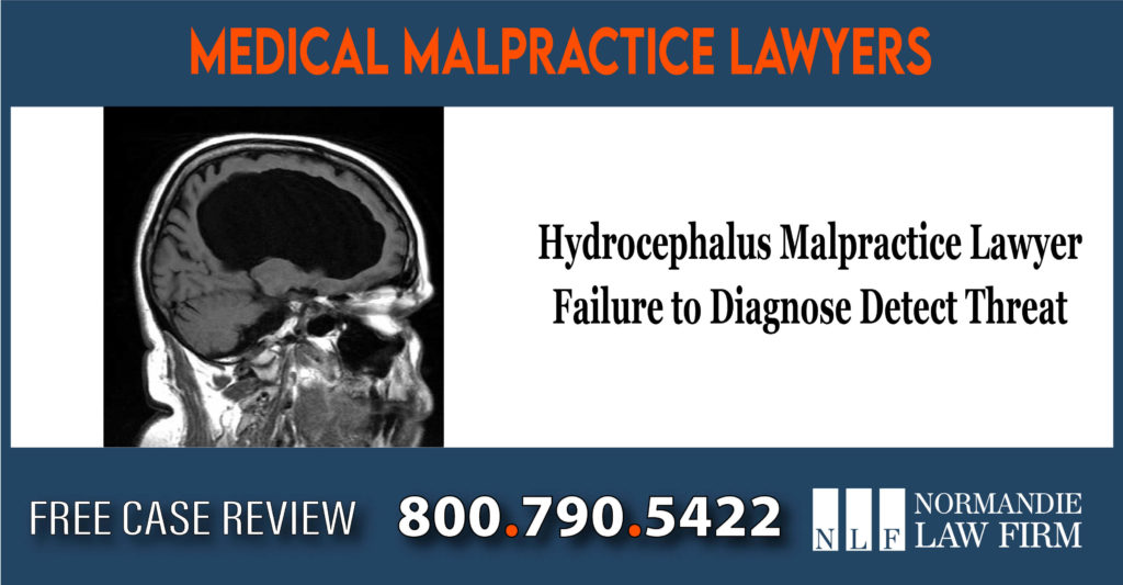 Hydrocephalus Malpractice Lawyer - Failure to Diagnose Detect Treat Resulting in Brain Injury and Death - Lawsuit - Attorney sue
