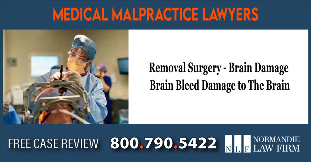 Removal Surgery - Brain Damage - Brain Bleed - Damage to The Brain lawyer attorney