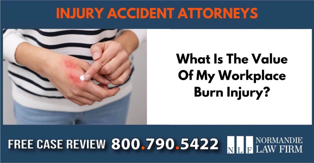 What Is The Value Of My Workplace Burn Injury