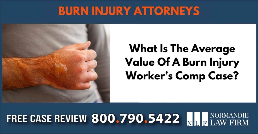 What Is The Average Value Of A Burn Injury Worker’s Comp Case sue liable employee rights