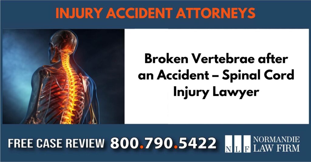 Broken Vertebrae after an Accident – Spinal Cord Injury Lawyer sue liable incident attorney